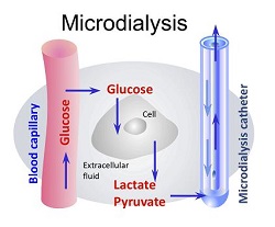 MD_method_diagram_small