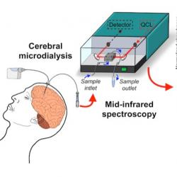 Cerebral Microdialysis analysed by mid-infrared spectroscopy to detect glucose lactate and pyruvate